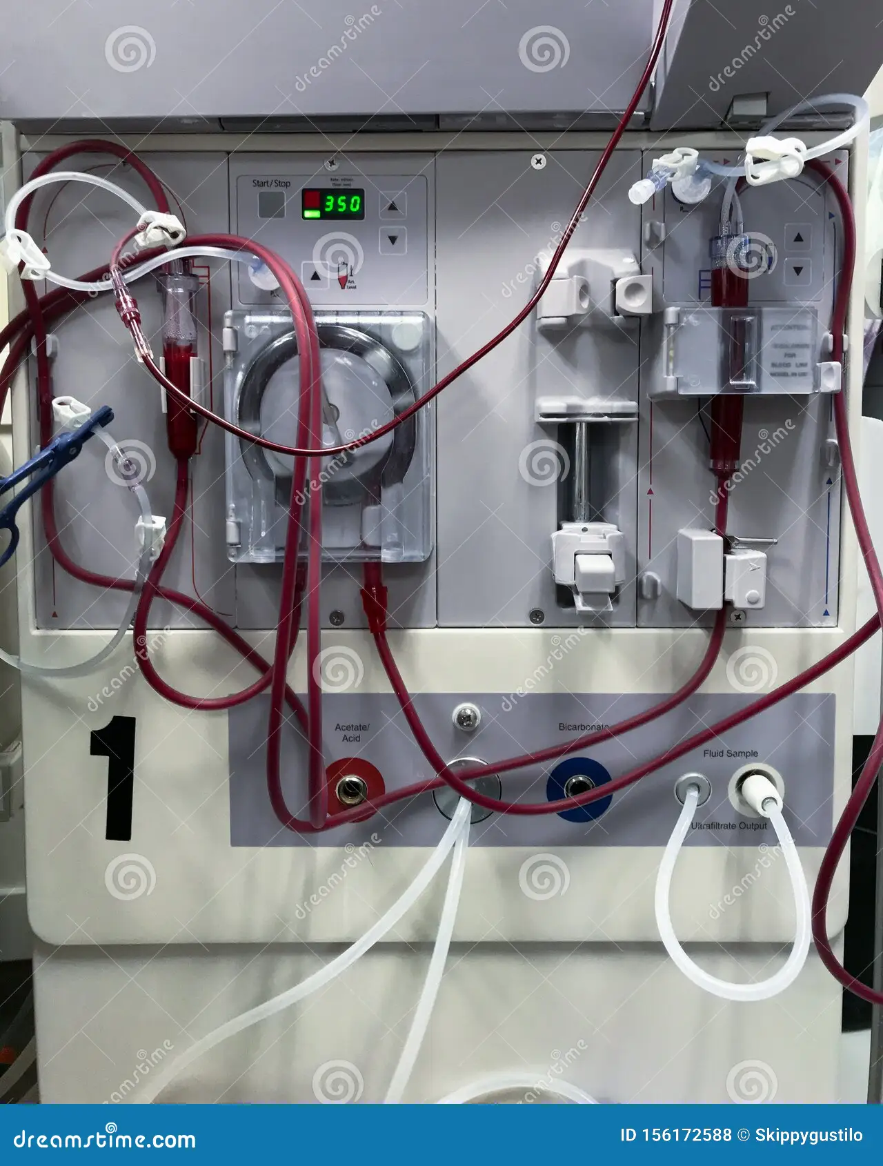 Renal ultrasound scan Renin Hospital Mancherial