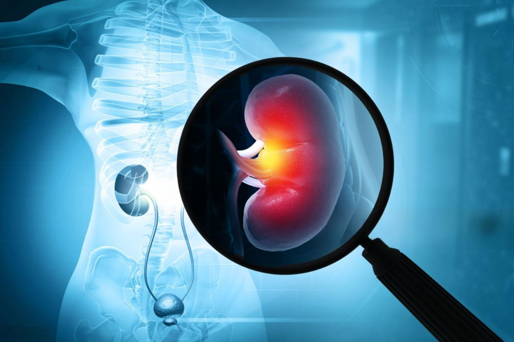 ICU with nephrology specialists at Renin Superspeciality